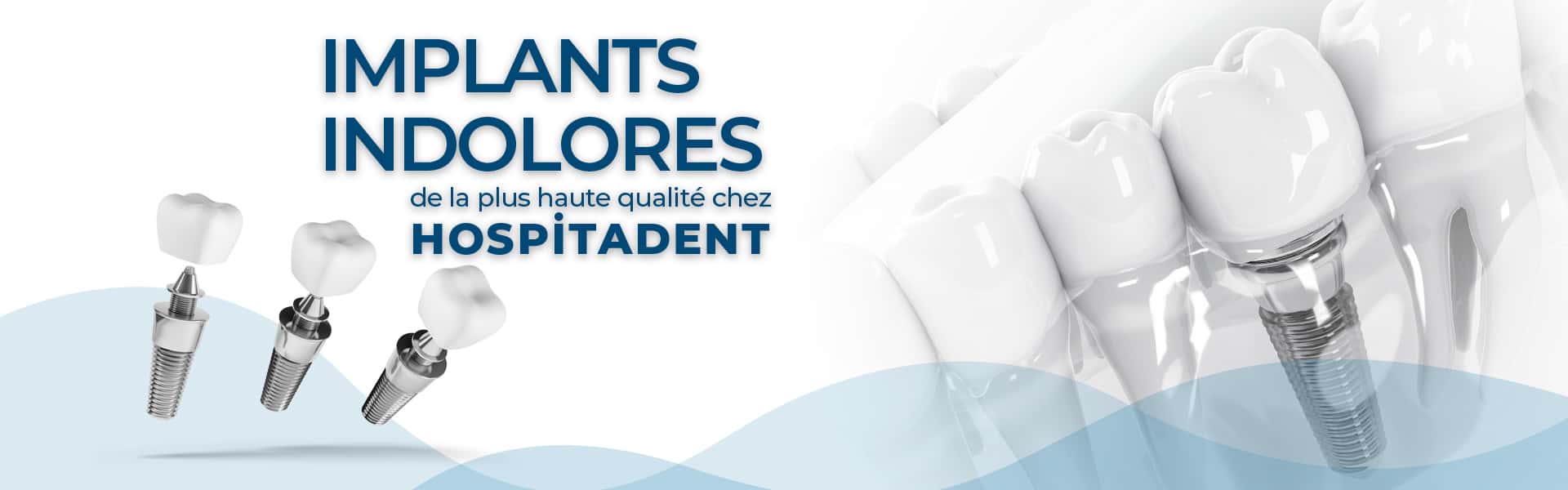 implant-1920×600-fra-yeni implant 1920x600 fra yeni Anasayfa - France