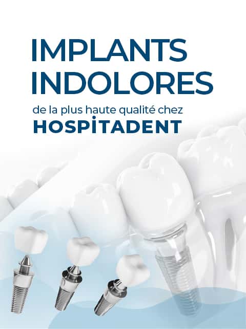 Anasayfa - France 15 implant 480x640 fra Anasayfa - France