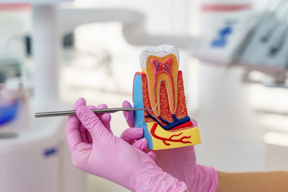 root canal treatment