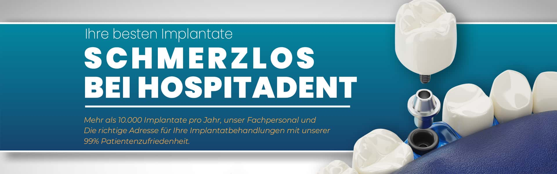 implant 1920x600 alm yeni Zahnkliniken Gruppe Hospitadent - Zahnklinik