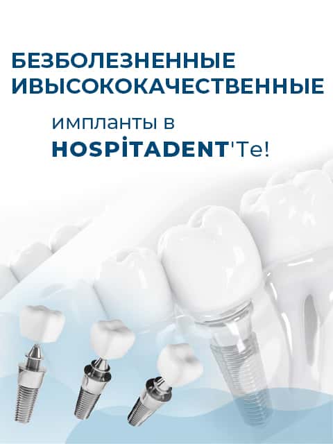 implant 480x640 ru Стоматологическая больница Dental Group Hospitadent