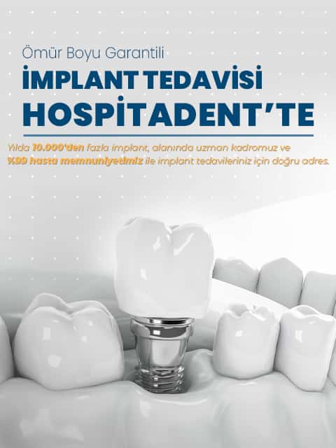 implant 480x640 tr Hospitadent Diş Hastanesi