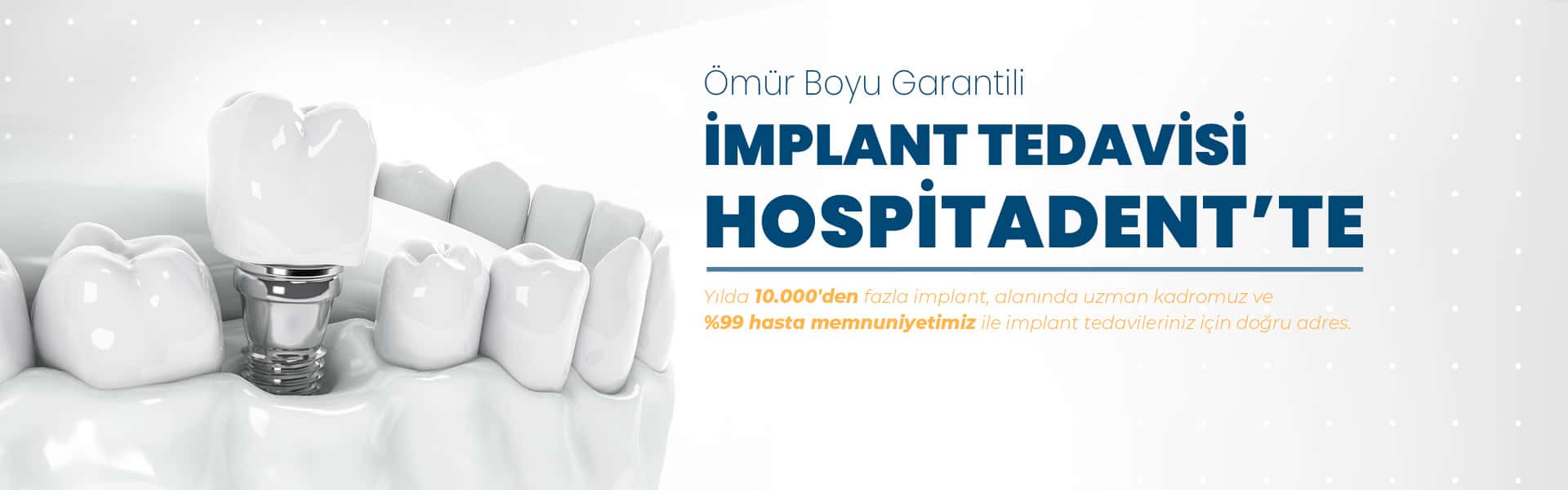 implant1 920x600 tr yeni Anasayfa
