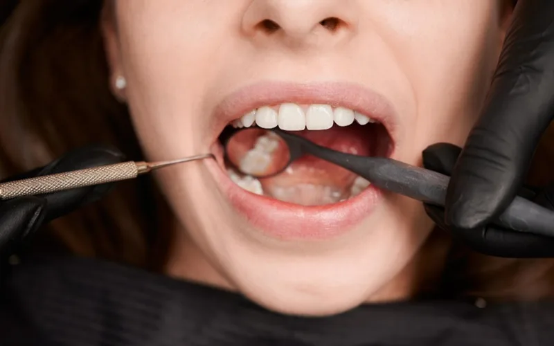 bone graft