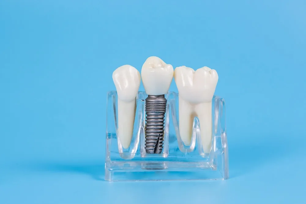 straumann implant