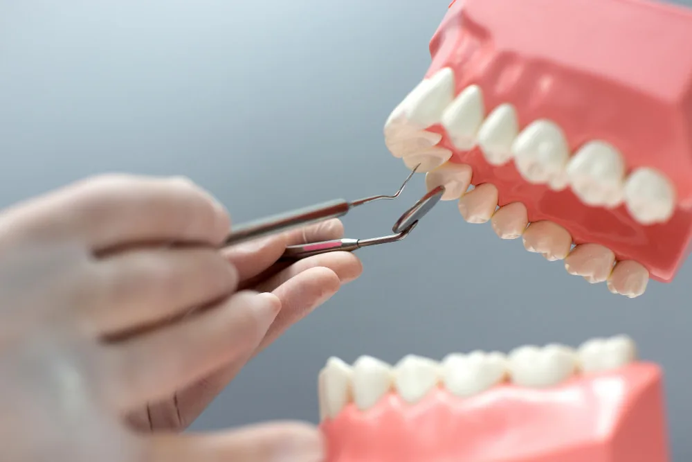 dental bridge